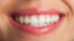 confiDENT Teeth Whitening